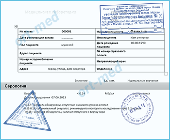 Купить тест на антитела к вирусу кори Купить справку тест на антитела к вирусу кори в Химках официально